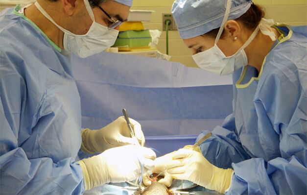 Opération pour augmenter un membre